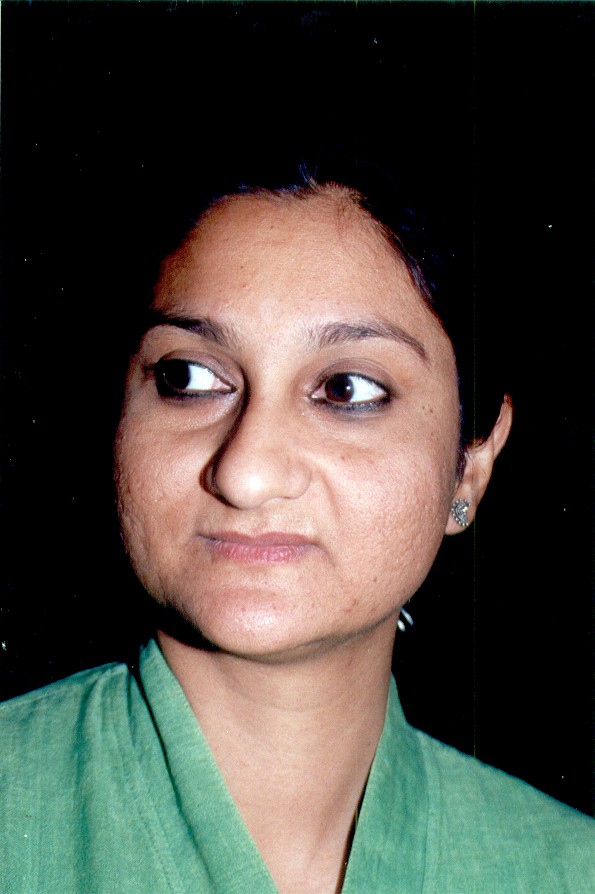 MANVITA BARADI